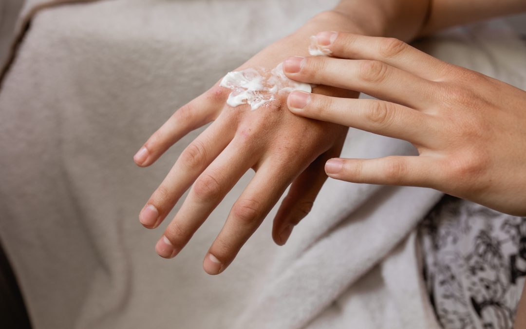 Eczema vs. Psoriasis – What’s the Difference?
