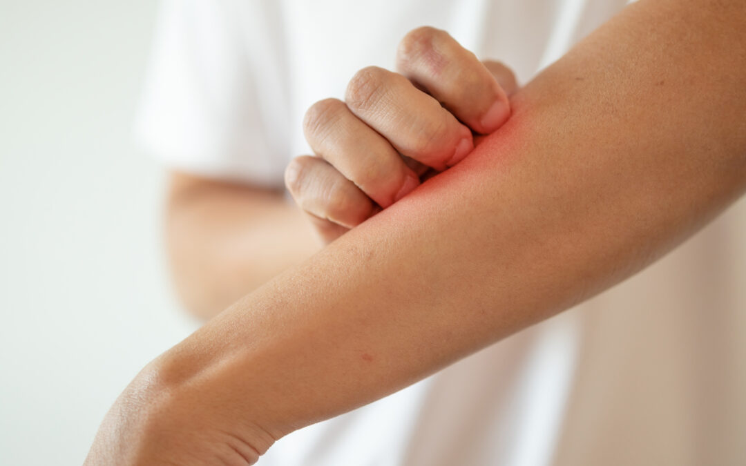 Understanding Dry Skin: Common Triggers and Solutions